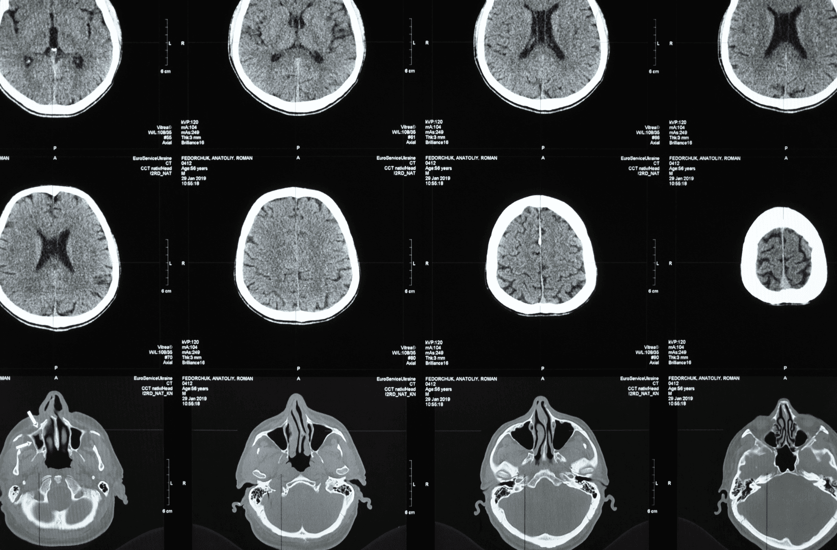 Visible Korean Human (VKH) image 1